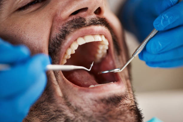 Best After-Hours Dental Trauma Care in Beechwood Village, KY