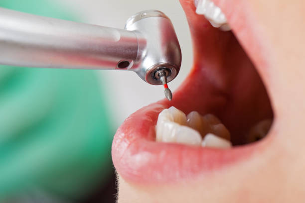 Best Emergency Treatment for Dental Infections or Abscesses in Beechwood Village, KY